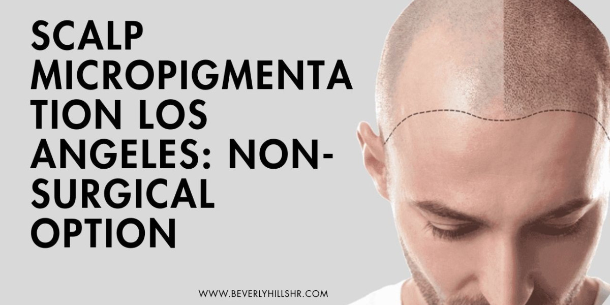 Scalp Micropigmentation Los Angeles: Non-Surgical Option
